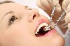 Teeth Implant in Delhi Picture